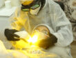Treatment Yellow Laser Terbaik di Semarang