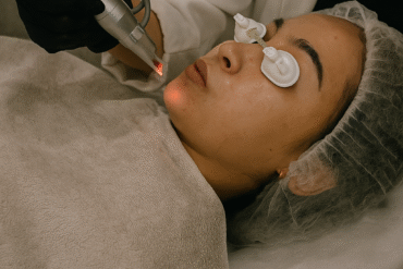 Treatment Facial Premium Terbaik di Semarang: Kulit Glowing, Sehat, dan Terawat di Lucent Pandanaran