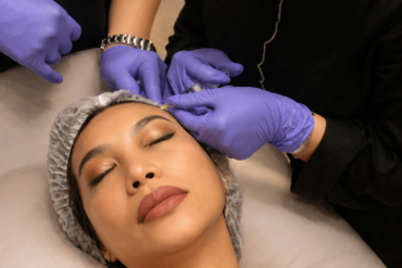 Botox Dahi Semarang: Solusi Efektif untuk Mengurangi Kerutan dan Membuat Wajah Tampak Lebih Segar
